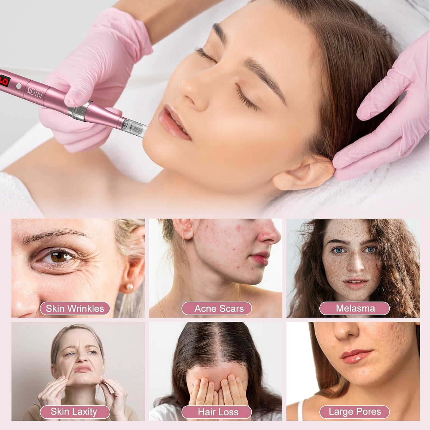 Microneedling Pen 9-Speeds, PELCAS Dermapen with LCD Screen 12 Replacement Pcs