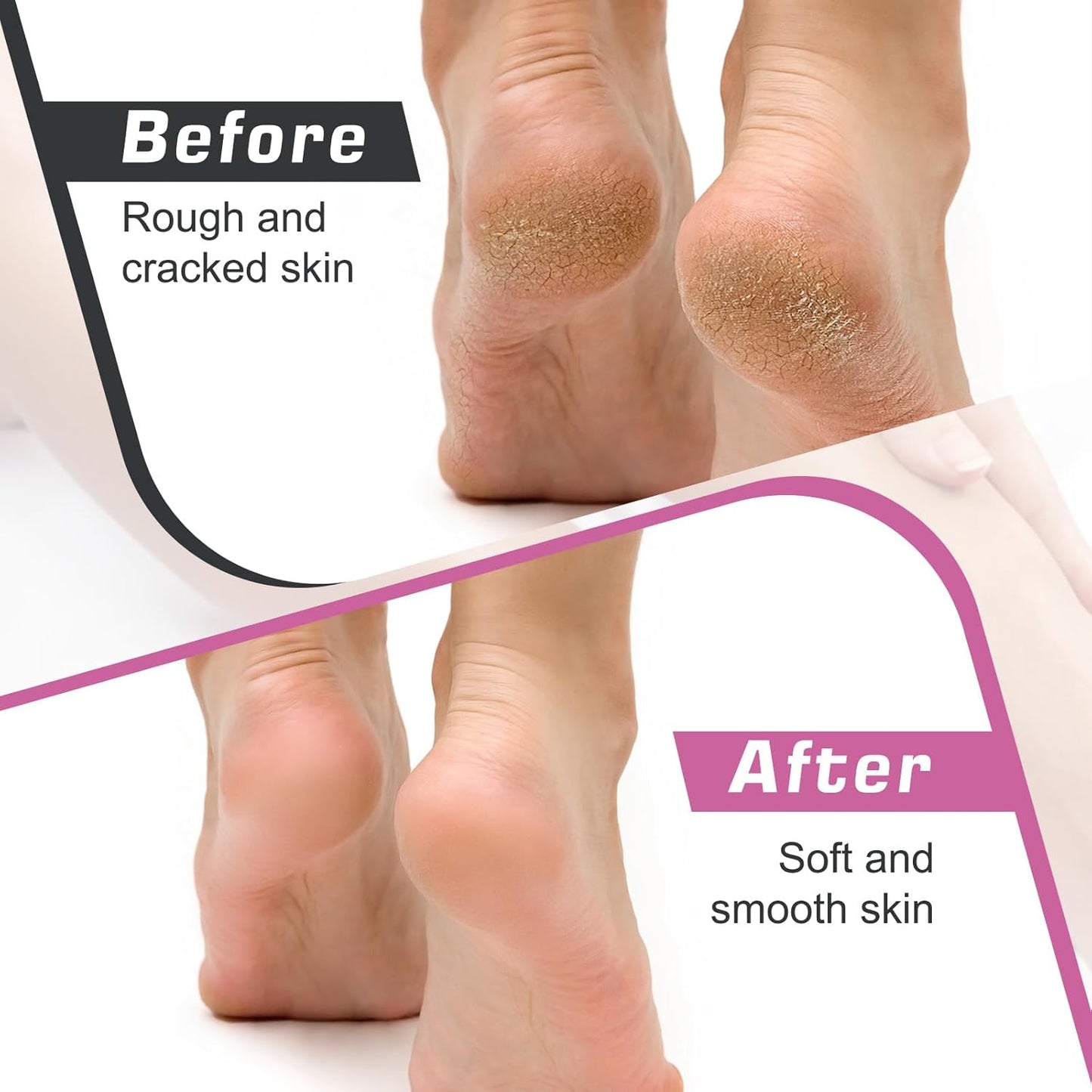 Before and after images of feet showing rough and cracked skin transformed using a professional pedicure tool with sandpaper discs