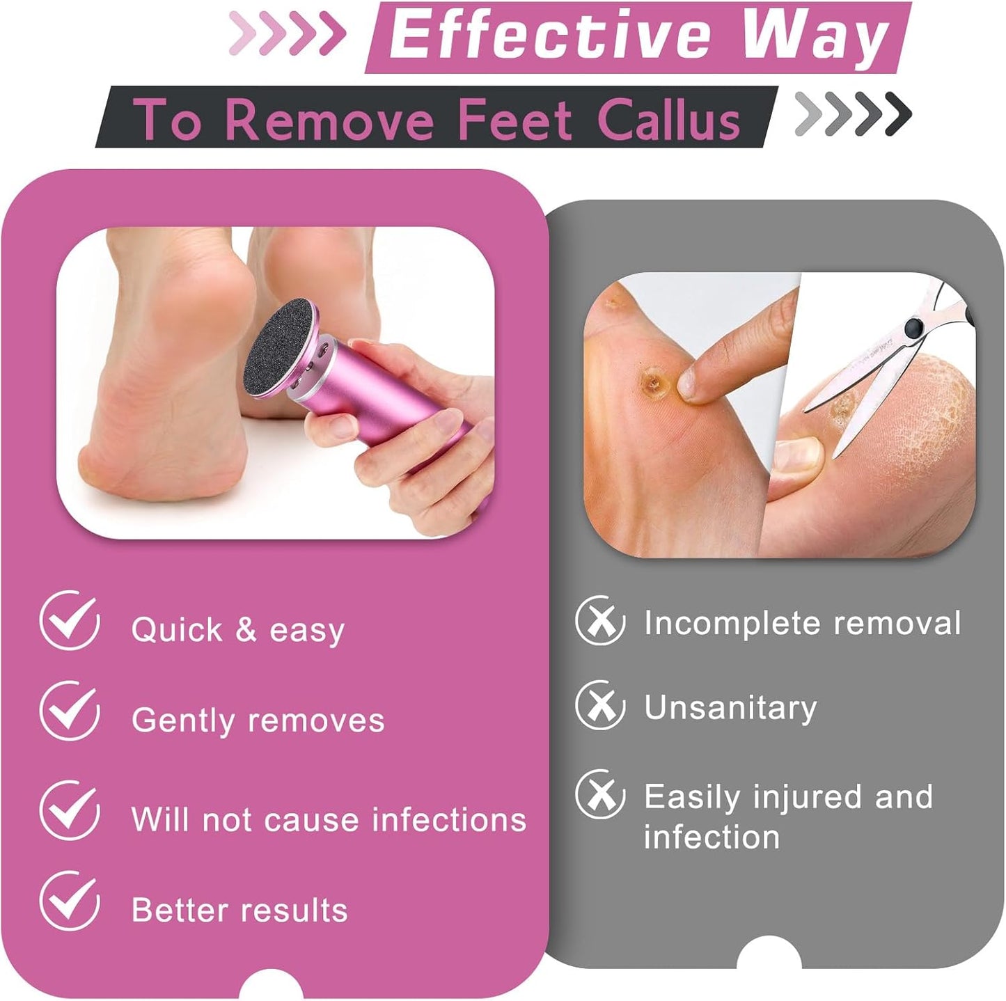 Romyse professional pedicure tool with sandpaper discs for effective callus removal and foot care