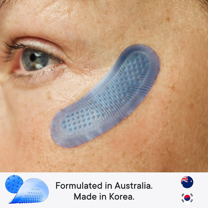 Qure Micro-Infusion Anti Wrinkle Patches for Smile Line, Frown lines, Under Eye Bags, Puffiness, Crow's Feet - Retinol, Caffeine - Dissolvable for Overnight Use - 8 Pairs