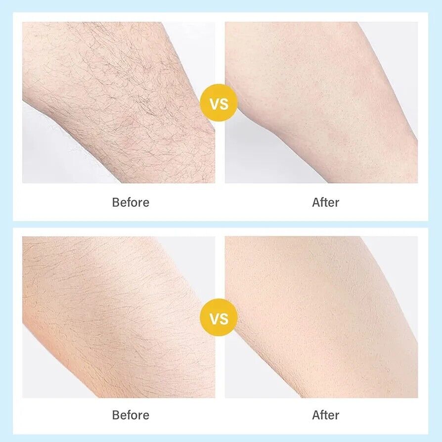 Before and after images showing smooth results with crystal hair eraser for legs